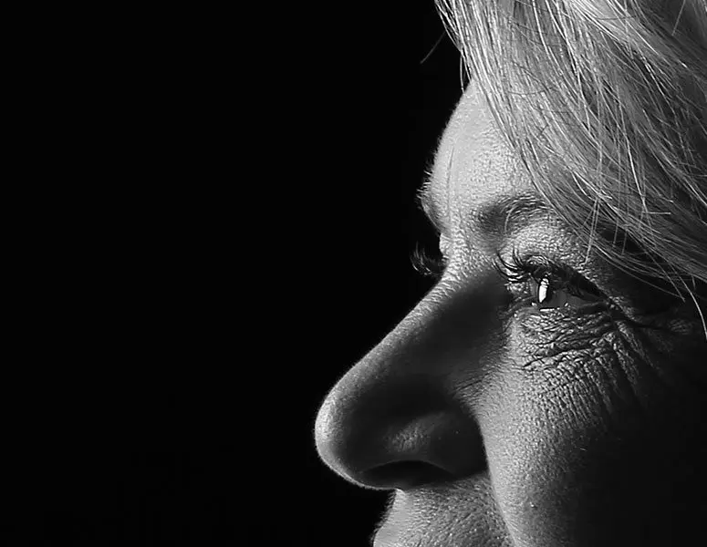 Glaucoma Monitoring & Screening