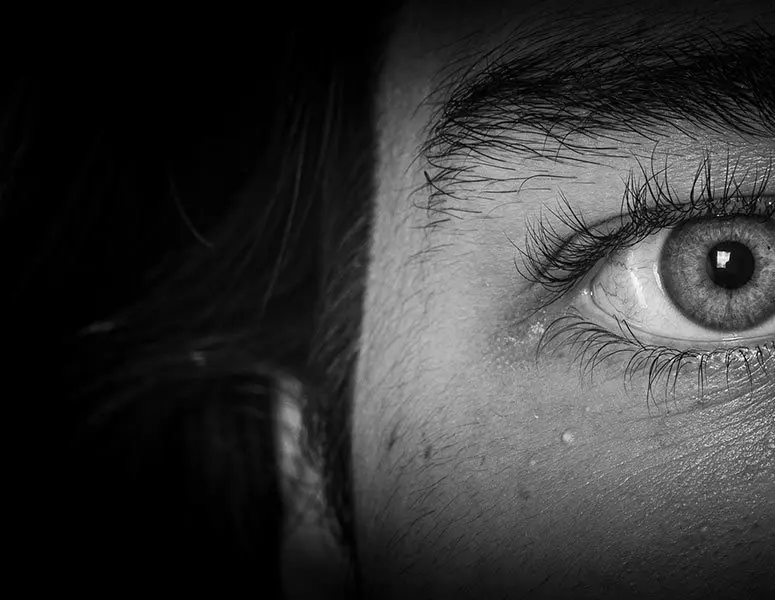 Meibomian Gland Dysfunction surgery