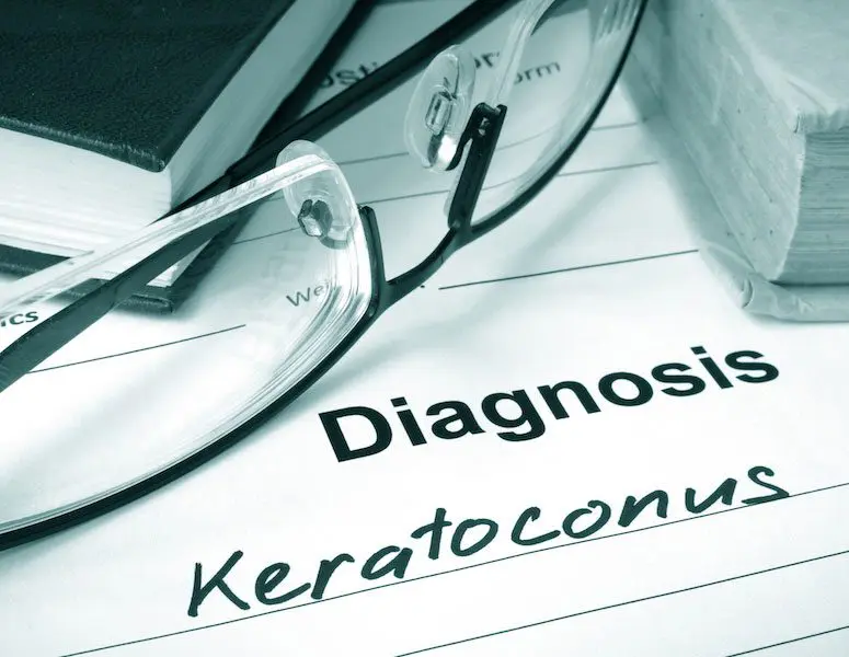 What Are The Symptoms Of Keratoconus?