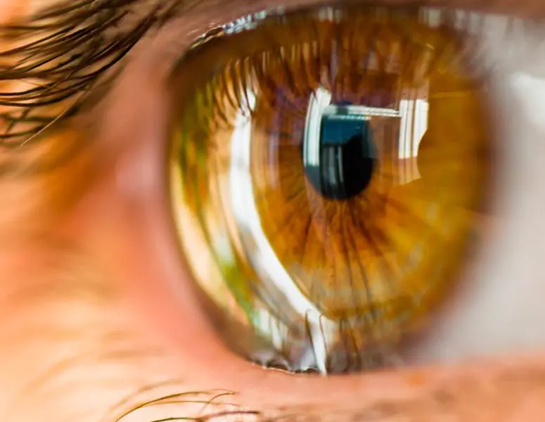 What is Keratoconus?