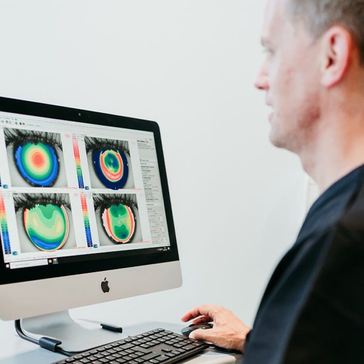 Narrow Anterior Chamber Angles Diagnosis