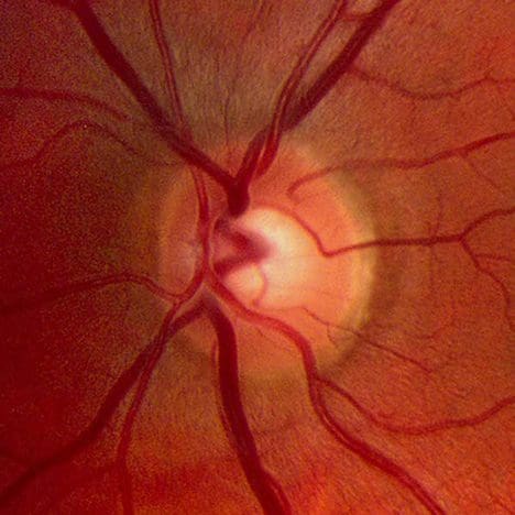3D Printed Nerve Cells Could Potentially Cure Blindness