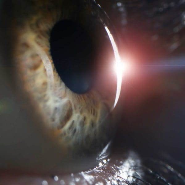 The Pros and Cons of Cataract Surgery