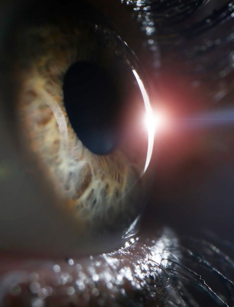 The Pros and Cons of Cataract Surgery