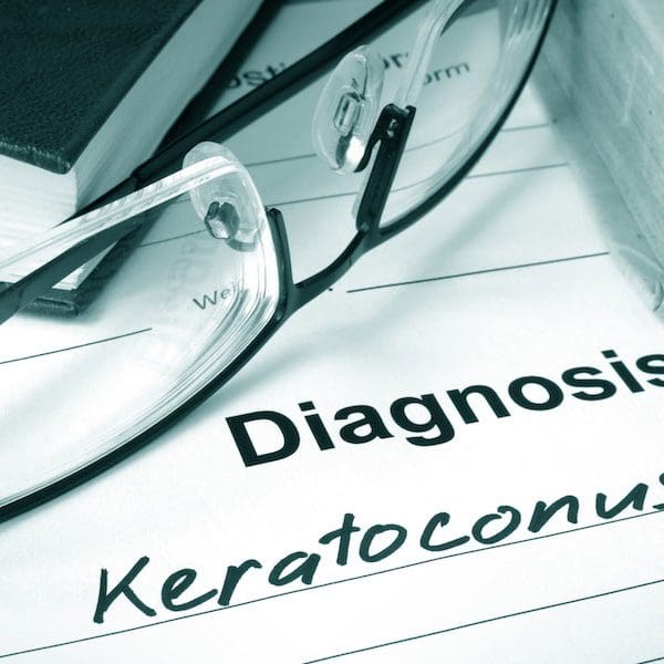 What Are The Symptoms Of Keratoconus?