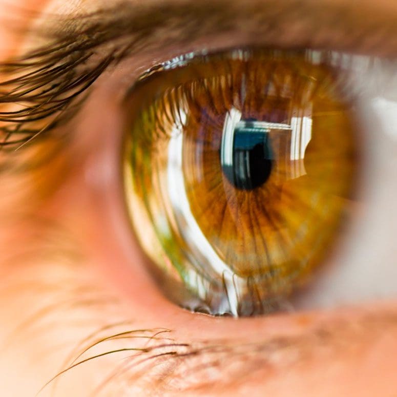 What is Keratoconus?