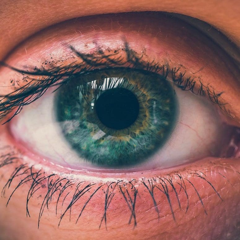 What is a Cataract?