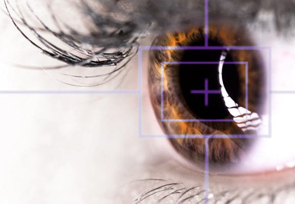 Q&A Series: The Laser Eye Surgery Procedure