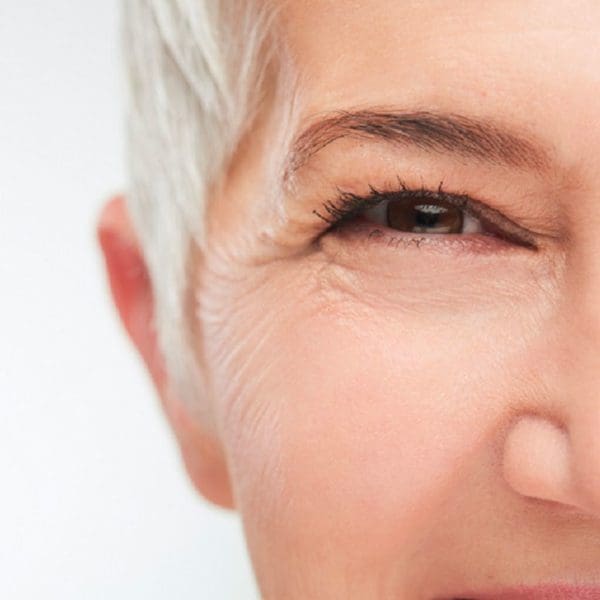 Are You Living with Cataracts?