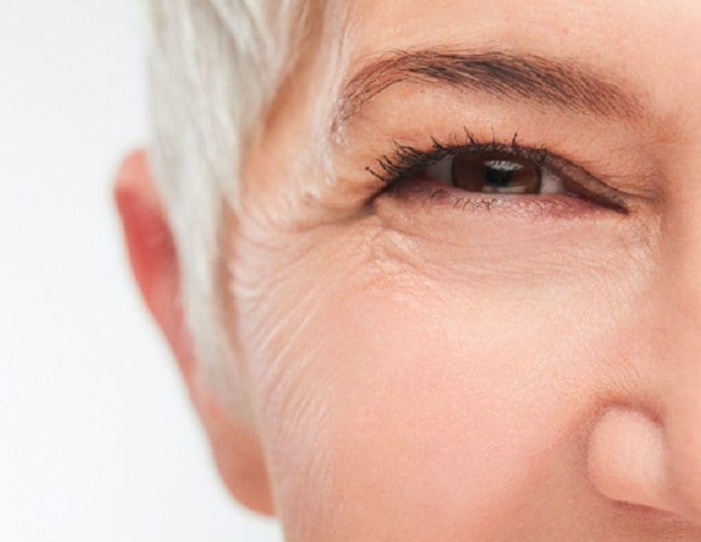 Are You Living with Cataracts?