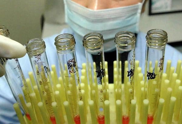 Breakthrough for Blindness Cure: New Stem Cell Research Could Reverse Blindness